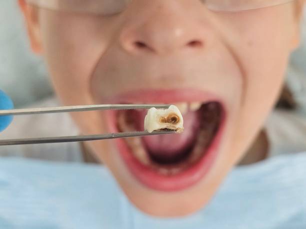 Best Broken Tooth Emergency  in Meadow Woods, FL